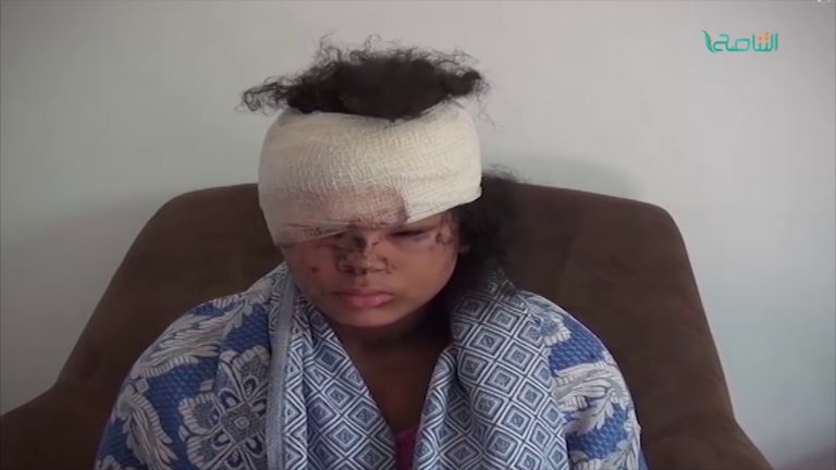 تقرير- حوار المساء – الطغاة وأذرعهم الدينية