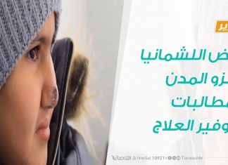 تقرير : مرض اللشمانيا يغزو المدن ومطالبات بتوفير العلاج