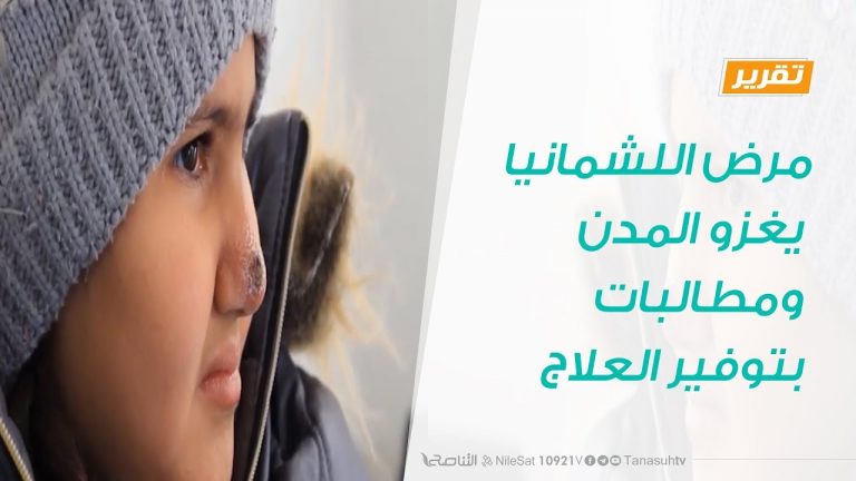 تقرير : مرض اللشمانيا يغزو المدن ومطالبات بتوفير العلاج