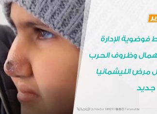 تقرير : وسط فوضوية الإدارة والإهمال وظروف الحرب يُطل مرض الليشمانيا من جديد | 30 – 10- 2019