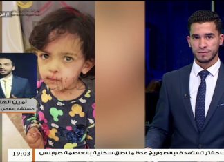 أمين الهاشمي / المستشار الإعلامي بوزارة الصحة : استهدفت ميليشيات حفتر منازل المواطنيين مما أسفر عن أصابة 7 أفراد بينهم طفلين من عائلة واحدة ….. المزيد في سياق المداخلة