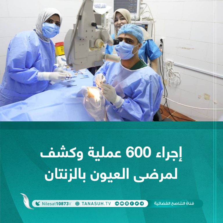 إجراء 600 عملية وكشف لمرضى العيون بالزنتان